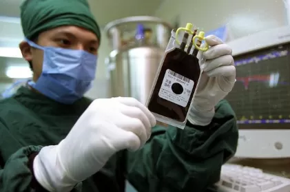 脐带血有必要保存吗2