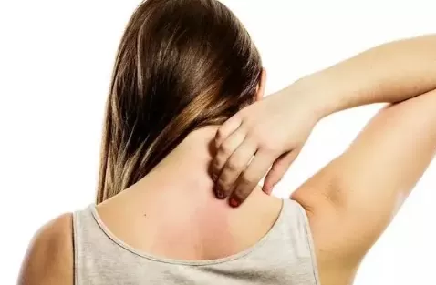 身上莫名发痒是螨虫吗