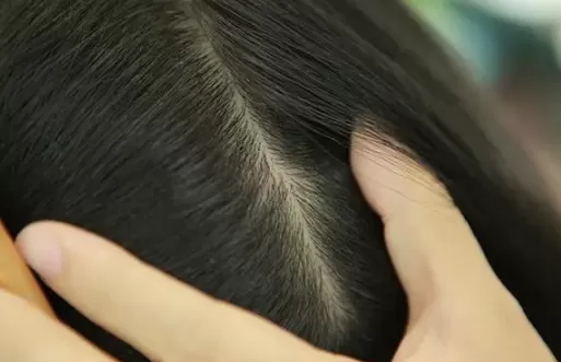 晚上头靠枕头头皮就非常痒怎么回事