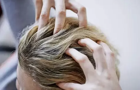 睡觉时头皮痒越抓越痒像过敏一样