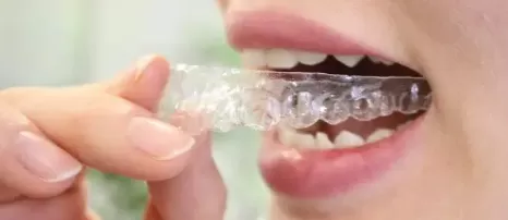 后槽牙崩了一小块要补吗