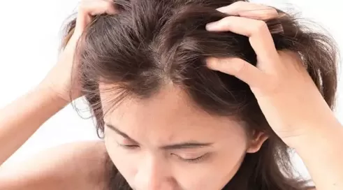 夏天的头皮能不能别痒了