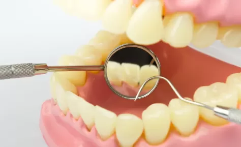 牙齿内侧掉了小块碎片要紧吗