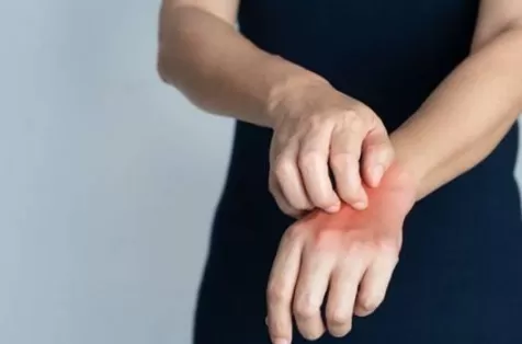 身上莫名发痒是螨虫吗