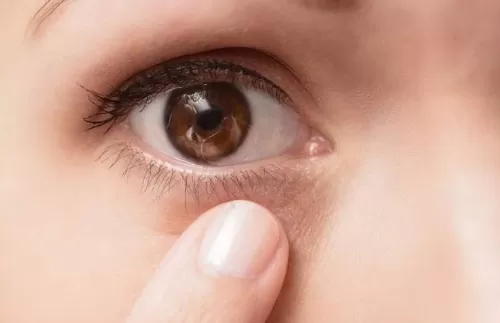 ​ok镜可以矫正散光吗