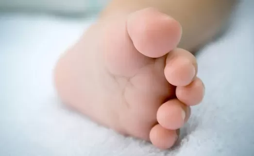 脚臭有什么办法除臭小妙招4