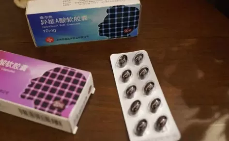 没有泰尔丝治不好的痤疮真的假的