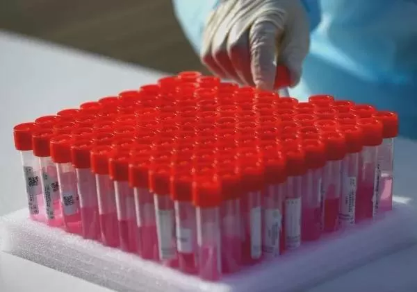 阳性感染者康复后多久可以上班 返岗建议一览