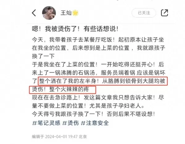 杜淳老婆王灿在外吃饭被烫伤 胳膊锁骨大腿中招 伤口处起水泡火辣辣的疼